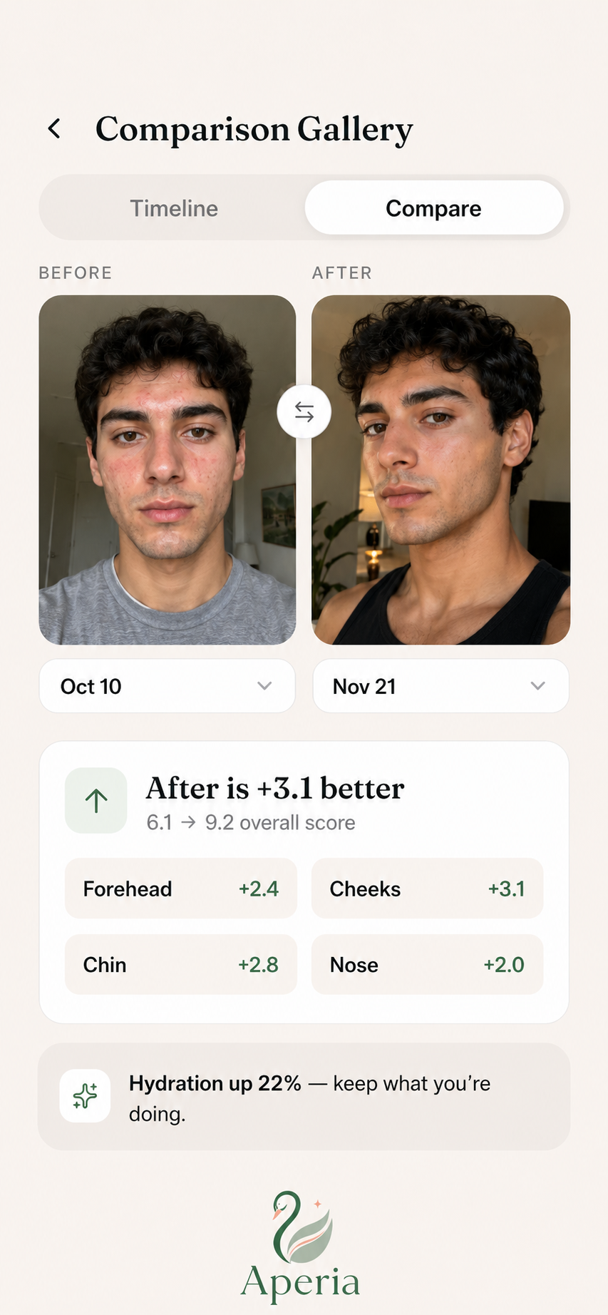 A real before and after journey in Aperia