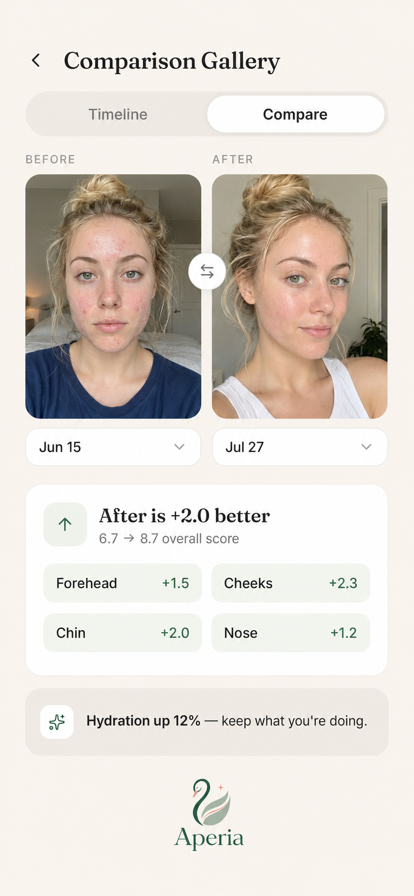 A real before and after journey in Aperia